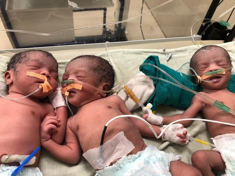 SHAHDOL : जिला अस्पताल में महिला ने दिया तीन बच्चों को जन्म